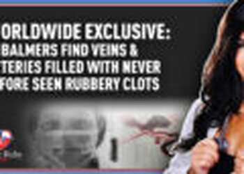 Worldwide Exclusive: Embalmers Find Veins & Arteries Filled with Never Before Seen Rubbery Clots